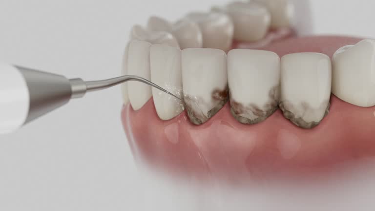 Reliable Teeth Cleaning And Checkup contractor in Baca County County, CO by Dentist Open Now
